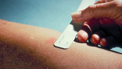 How TB Skin Test and Vaccines Can Make Traveling Safer